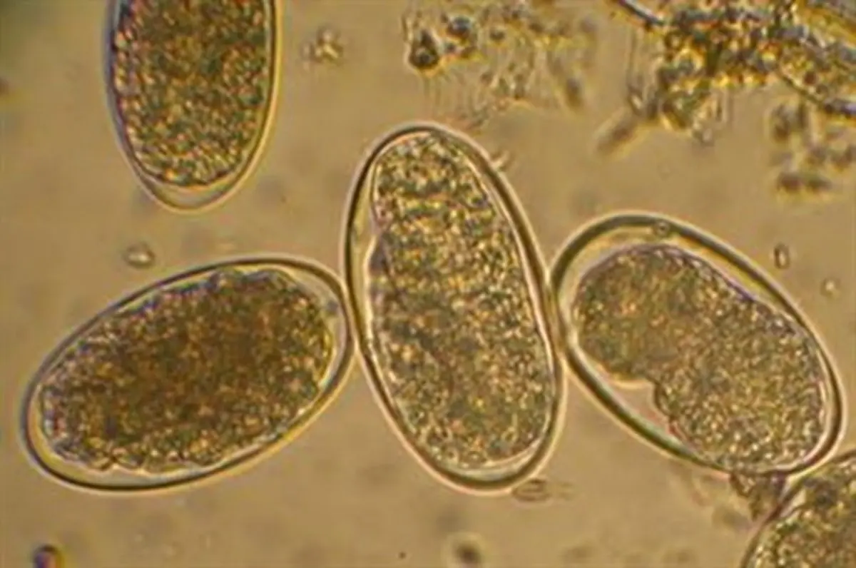 Thrums Vets : “Parasite eggs under microscope”