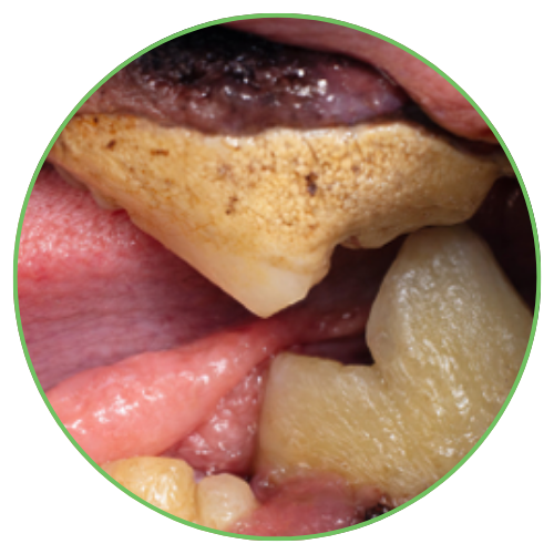 Thrums Vets: Stage 3 – Moderate periodontal disease Thrums Vets: Stage 3 - Moderate periodontal disease