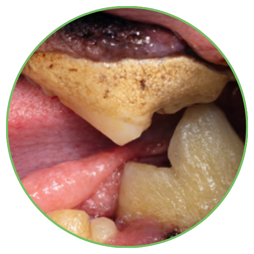 Thrums Vets: Stage 3 - Moderate periodontal disease